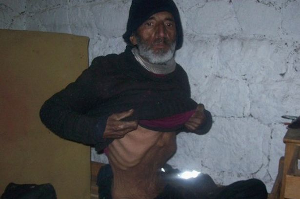 Чудодейно оцеляване в Андите